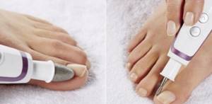 Hardware pedicure at home - how to do it with which cutters