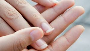 Reinforcement can save even the most weakened and thinned nails