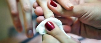 What to do if a splinter gets under your nail?