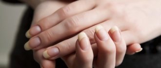 What is nail polishing and why is it needed?