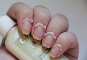 Why do you need a keratolytic in manicure?