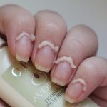 Why do you need a keratolytic in manicure?