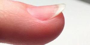 Естественная форма ногтей