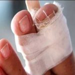 Photo: bandage for a receding nail