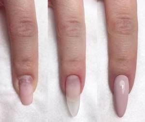 Photo of the nail extension process