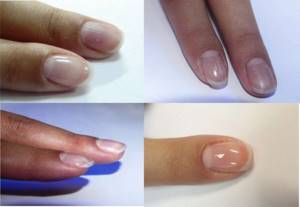 Instructions for strengthening nails with biogel