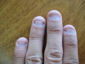 Как отрастить обгрызенные ногти?