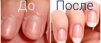 How to prevent the cuticle from growing?