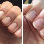 When do you need to straighten your nails?