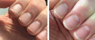 When do you need to straighten your nails?