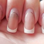 Correction of extended nails is necessary as they grow