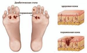 Who is a podiatrist and what problems does he solve?