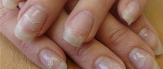 Treatment of fingernails and toenails after gel polish, extensions. Traditional recipes, pharmaceuticals, IBX system 