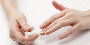 Brittle nails - reasons, how to treat