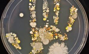 Микробы под микроскопом. Фото на руках, во рту, под ногтями. Какие бывают, как выглядят, презентация для детей
