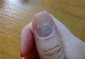 Неправильное снятие или излишний спил негативно отразятся на состоянии ногтевой пластины