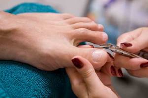 Treatment of nails and cuticles before pedicure at home