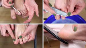 treatment of heels before pedicure at home
