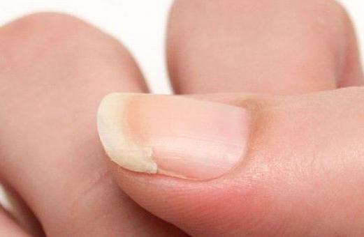 Why gel comes off nails: reasons Good gel polish. Gel polish application technology 