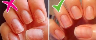 damaged nails after gel polish