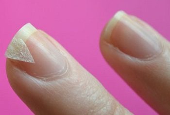 Процесс ремонта трещины ногтя