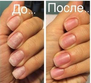 Strengthening nails with biogel before and after