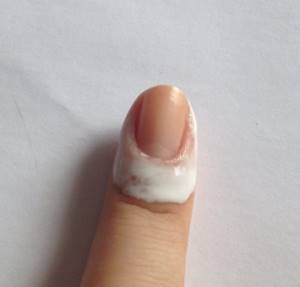 This is how you need to treat the skin around the nail with cream