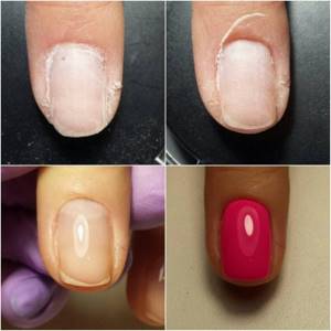 Выравнивание ногтевой пластины до и после
