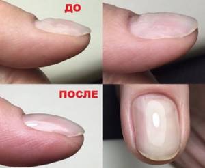 Alignment of the nail plate