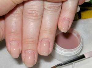 Sealing nails with biogel